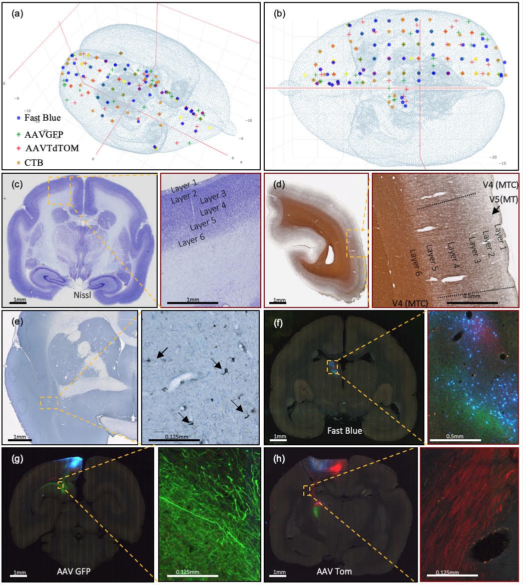 人気ブランド新作豊富 A high-throughput brain-wide for pipeline neurohistological ギター