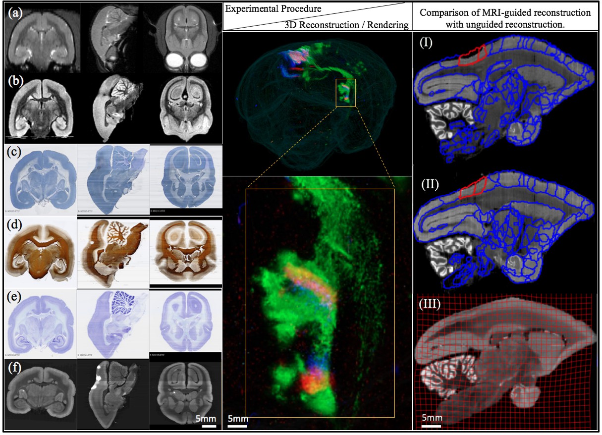 A high-throughput neurohistological pipeline for brain-wide