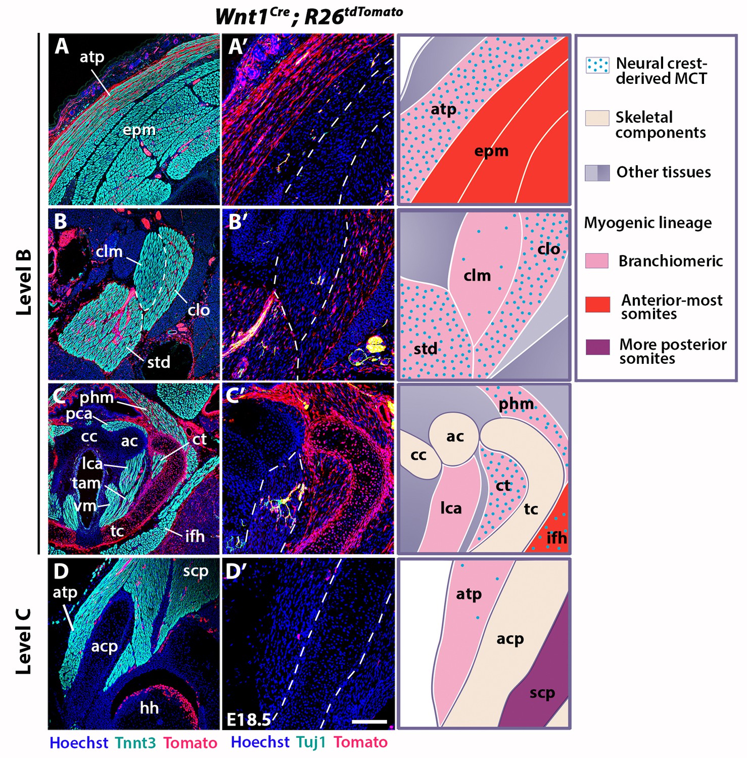 Humanized skeletal muscle in MYF5/MYOD/MYF6-null pig embryos