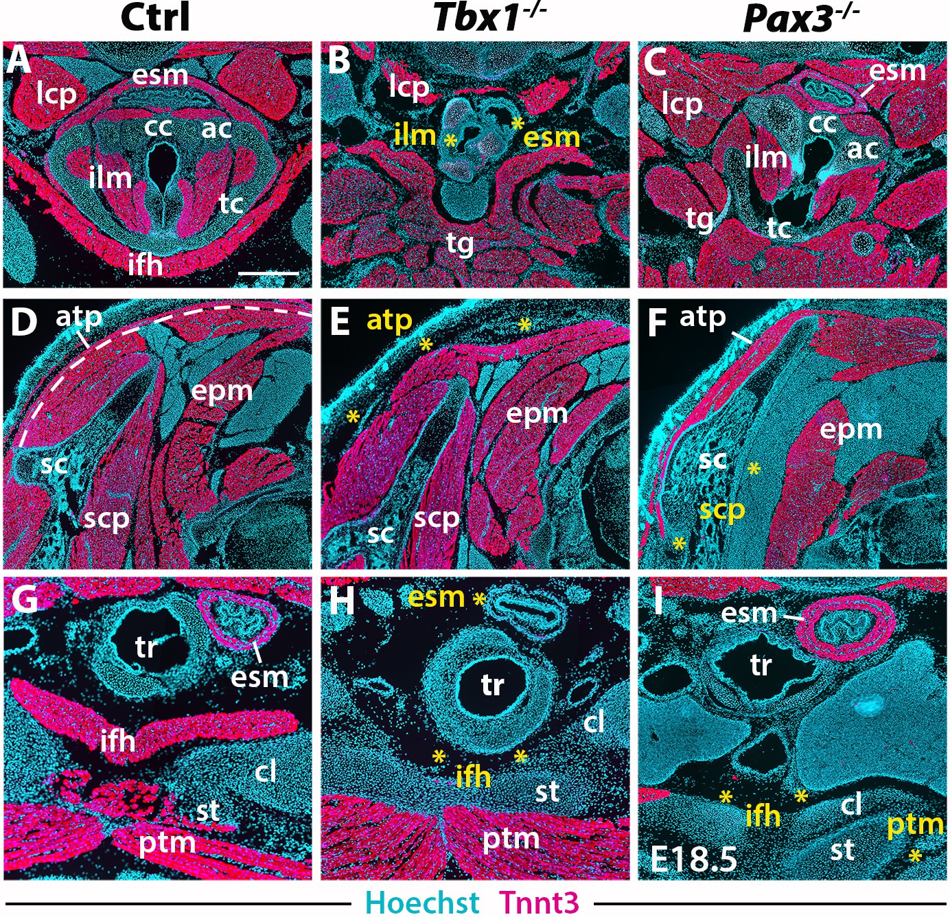 Humanized skeletal muscle in MYF5/MYOD/MYF6-null pig embryos