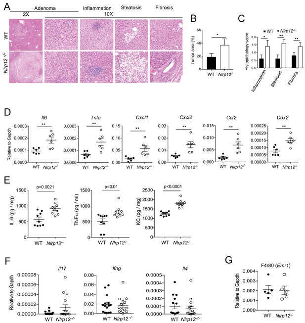 Figures and data in NLRP12 suppresses hepatocellular carcinoma via ...