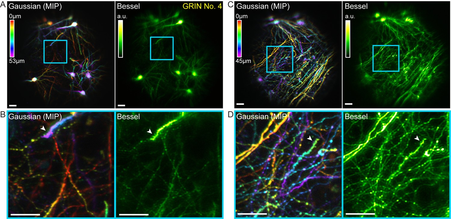 Figures And Data In High-throughput Synapse-resolving Two-photon ...