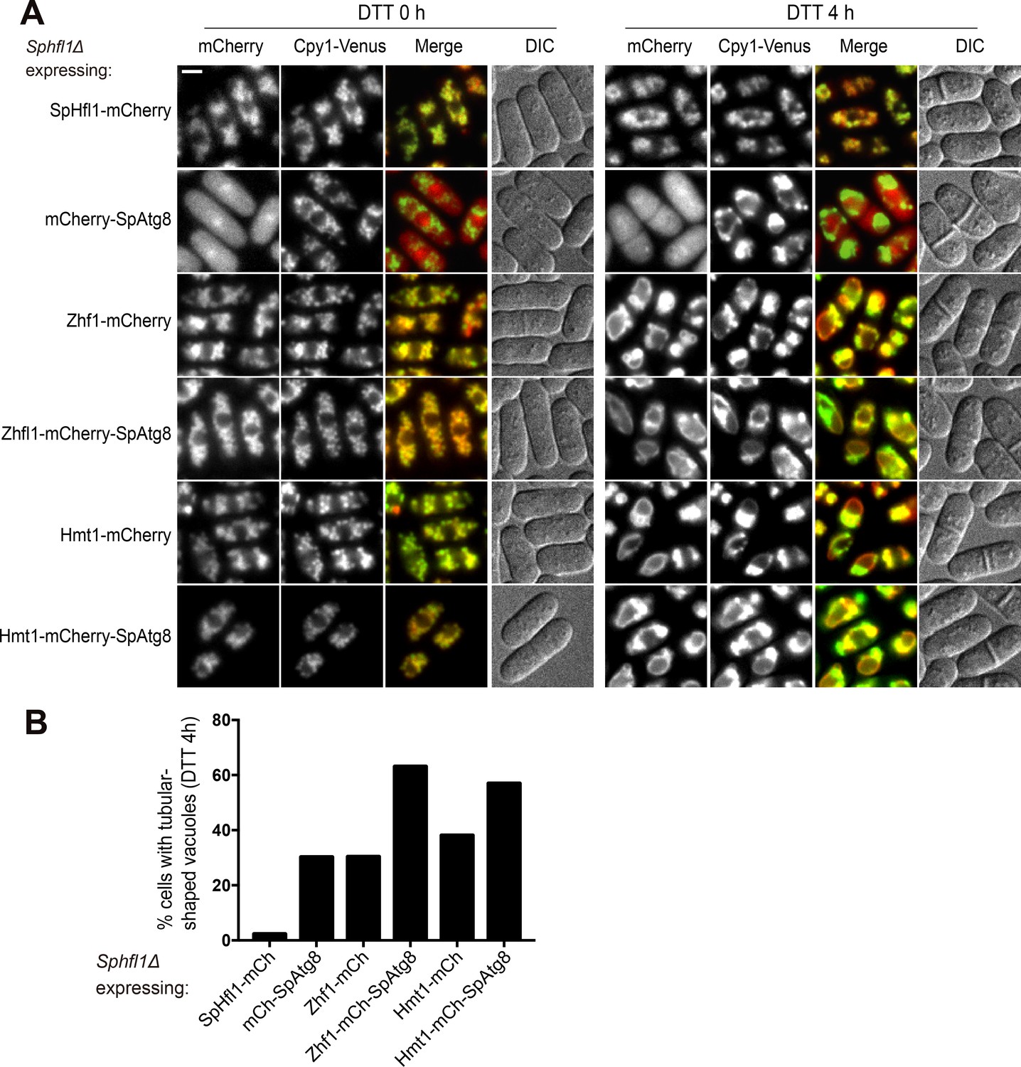 Figures And Data In Lipidation Independent Vacuolar Functions Of Atg