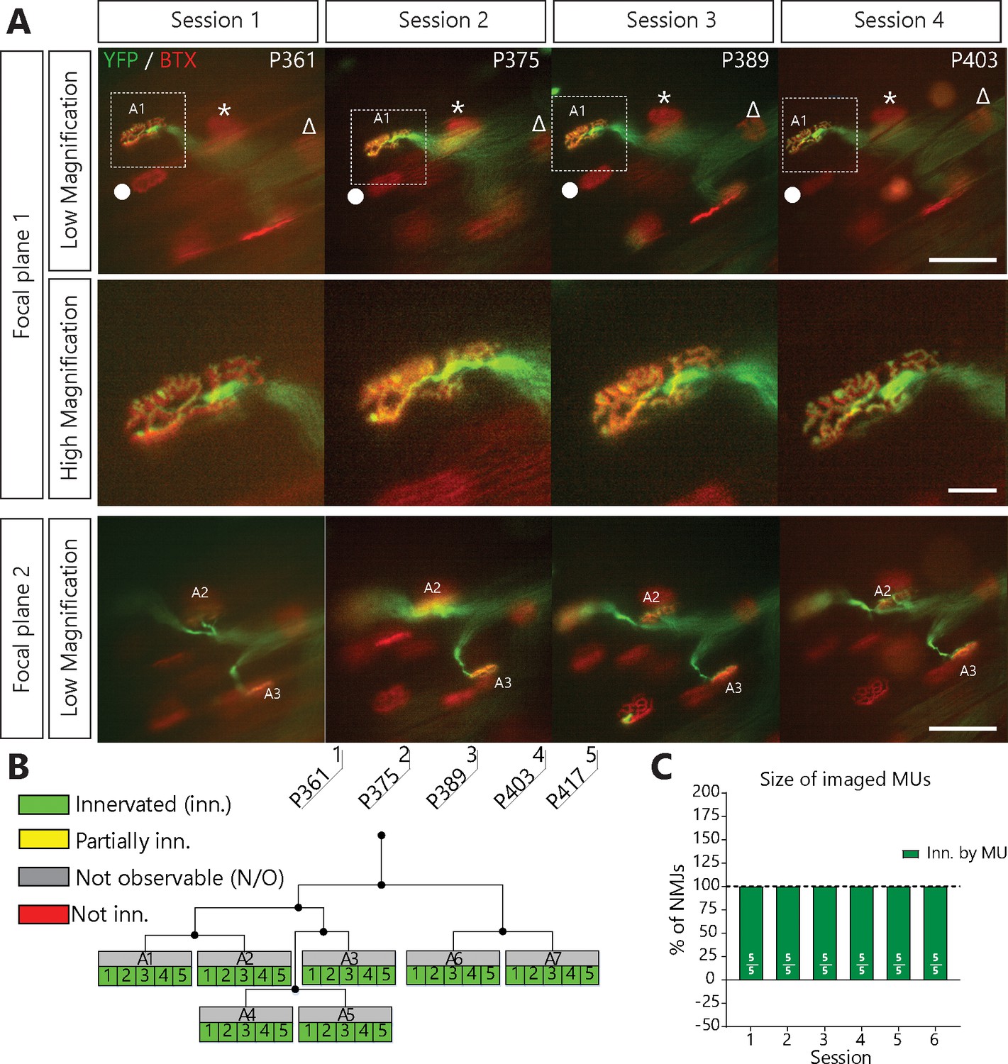 Dynamic Neuromuscular Remodeling Precedes Motor Unit Loss In A Mouse Model Of Als Elife