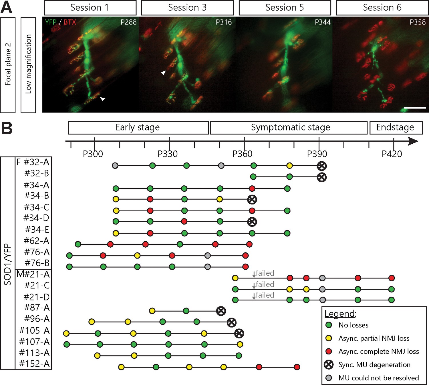 Dynamic Neuromuscular Remodeling Precedes Motor Unit Loss In A Mouse Model Of Als Elife