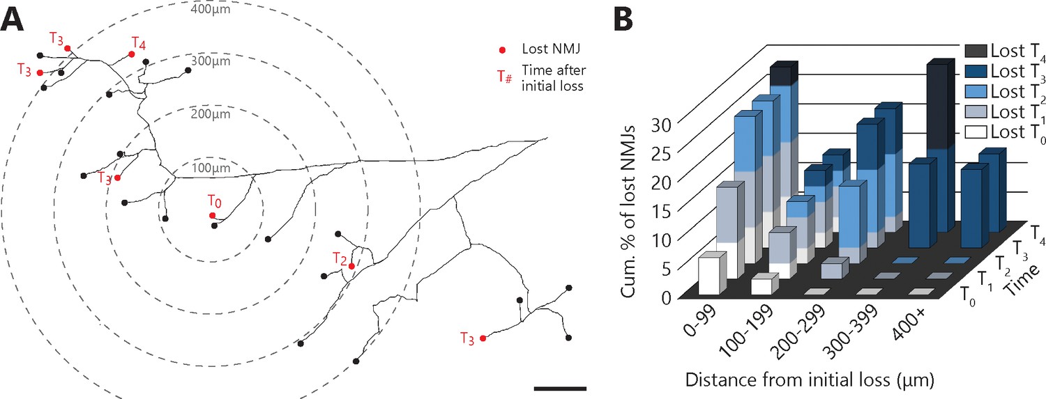 Dynamic Neuromuscular Remodeling Precedes Motor Unit Loss In A Mouse Model Of Als Elife