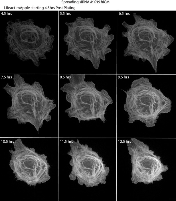 Figures and data in Muscle-specific stress fibers give rise to ...