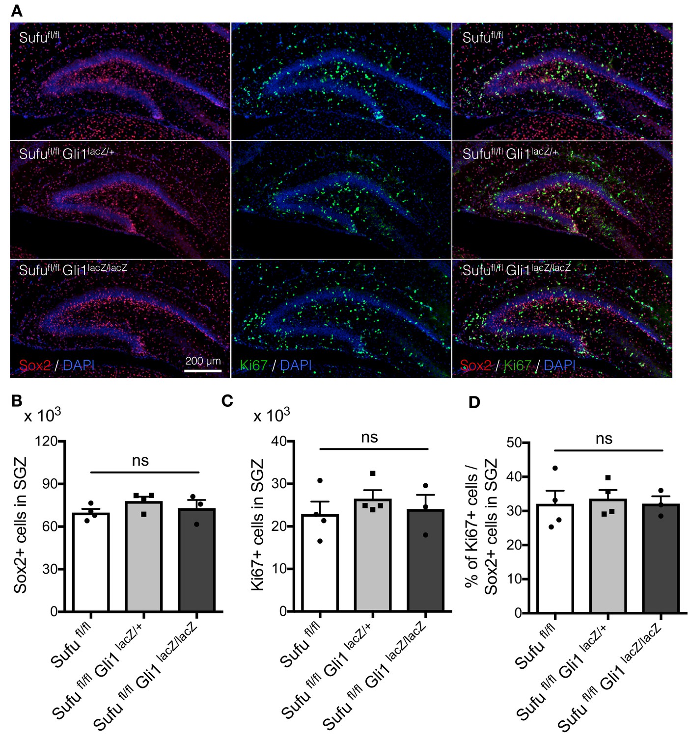 Figures and data in Suppressor of fused controls perinatal expansion ...