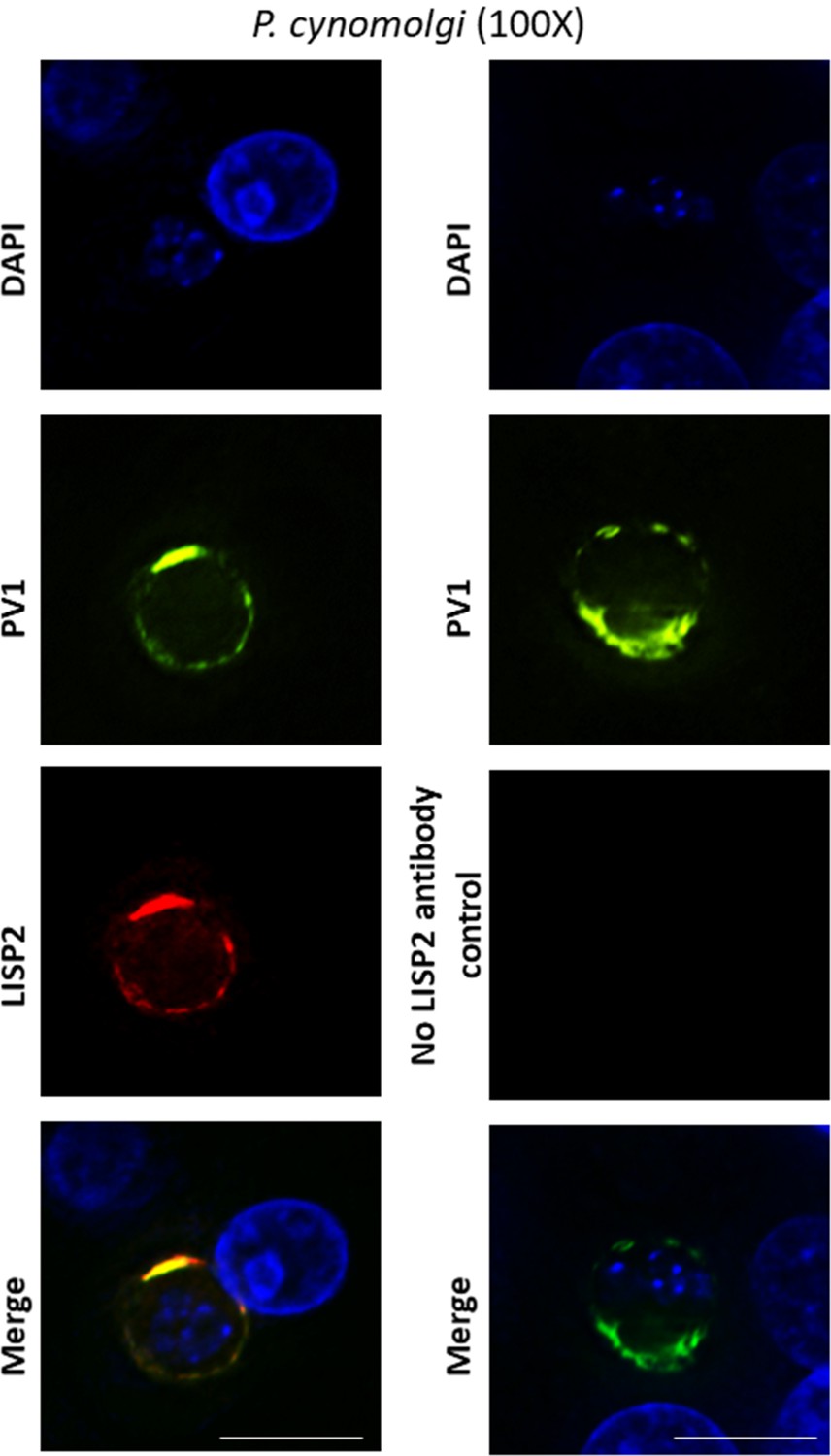 Figures and data in the plasmodium liver specific protein 2 lisp2 is