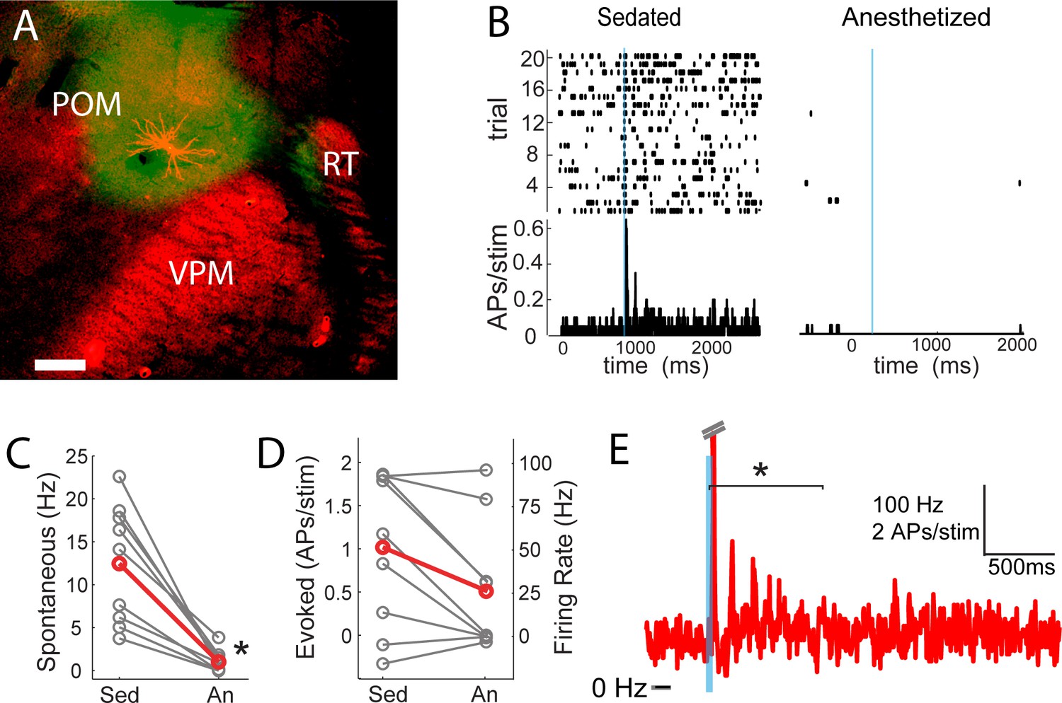 Figures and data in High-order thalamic inputs to primary somatosensory ...