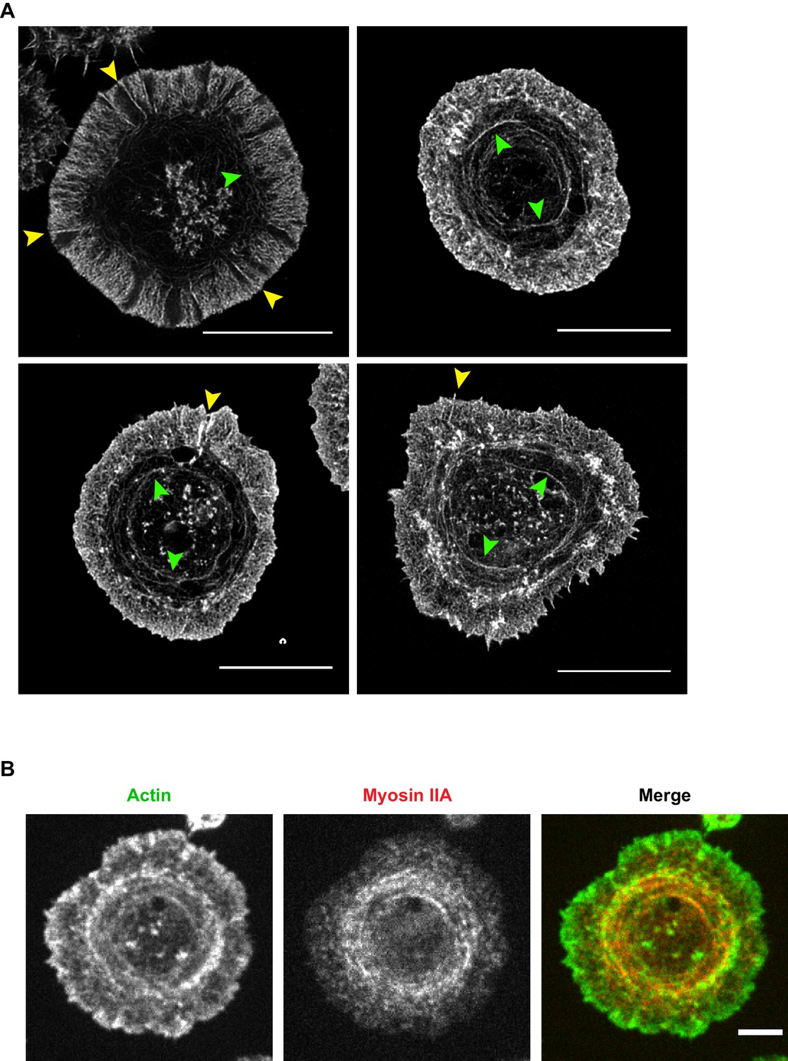 Figures And Data In Arp2/3 Complex-driven Spatial Patterning Of The BCR ...