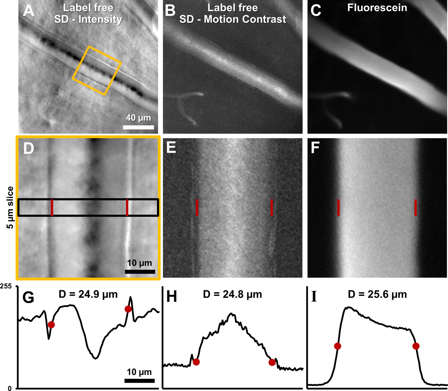 Frontiers  Retinal Vessel Responses to Flicker Stimulation Are