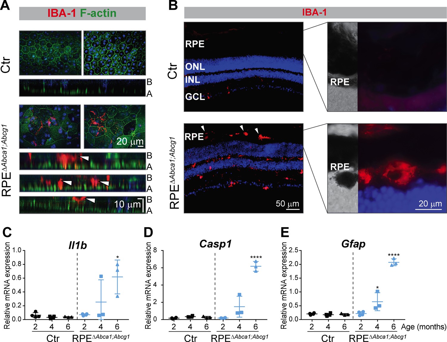 Impaired ABCA1/ABCG1-mediated lipid efflux in the mouse retinal pigment  epithelium (RPE) leads to retinal degeneration | eLife