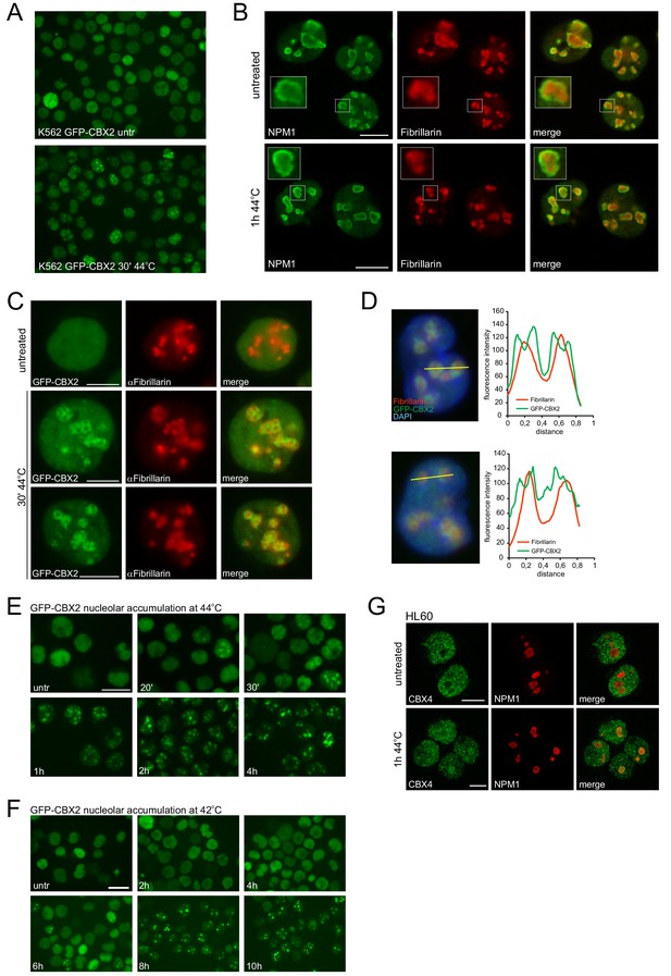 Figures and data in Protein quality control in the nucleolus safeguards ...