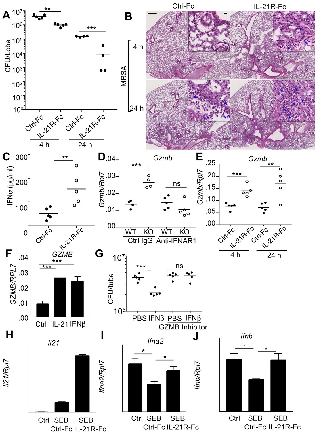 IL-21/type I interferon interplay regulates neutrophil