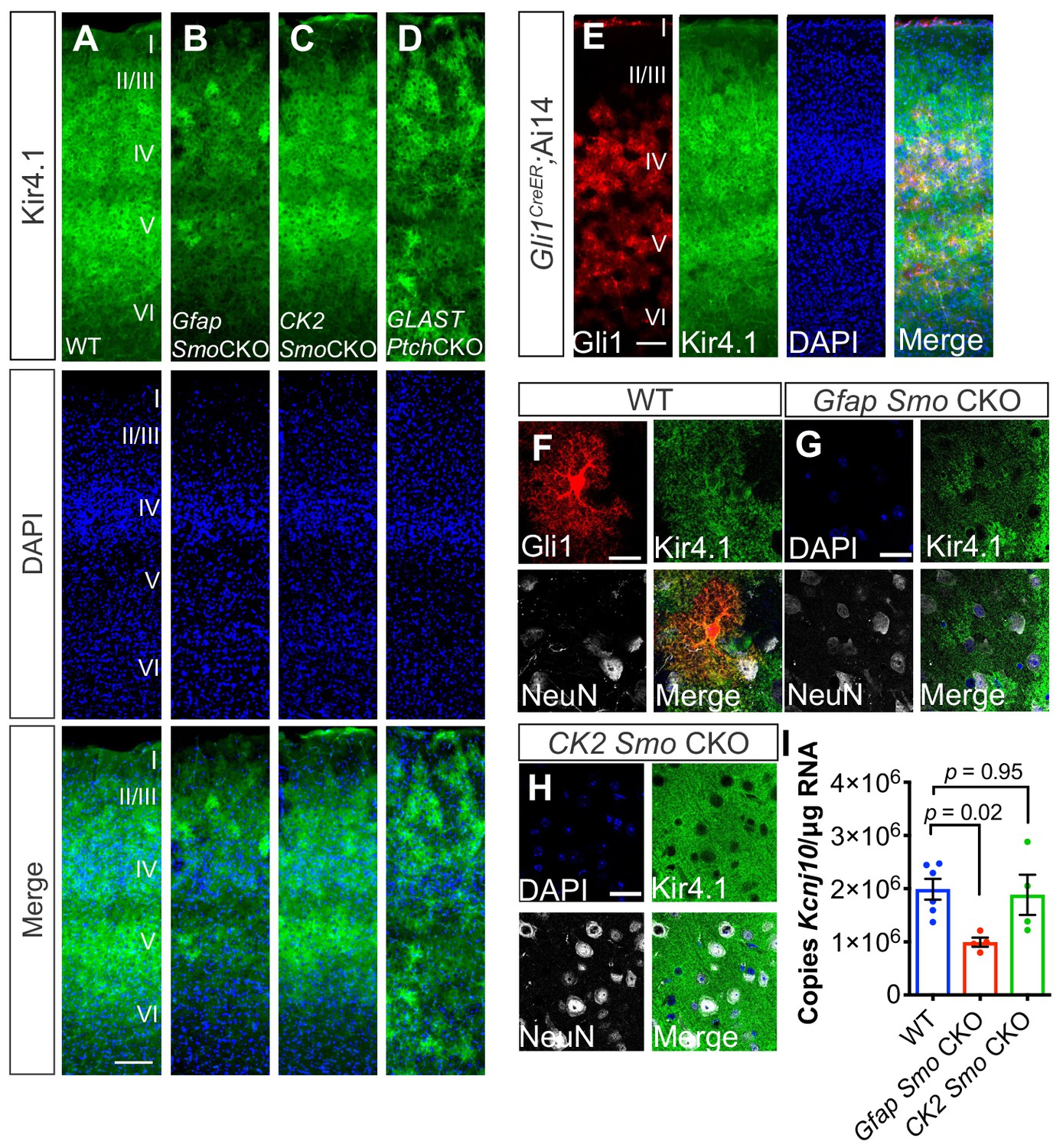 Sonic Hedgehog and Astrocytes » the nerve blog, Blog Archive