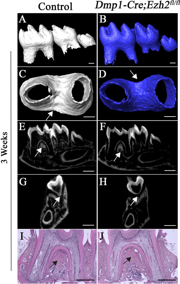 Figures and data in Antagonistic interaction between Ezh2 and Arid1a ...