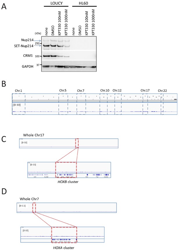 Figures And Data In Chromatin Bound CRM1 Recruits SET Nup214 And NPM1c