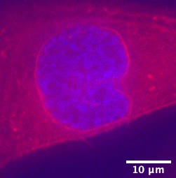 Contractile acto-myosin network on nuclear envelope remnants