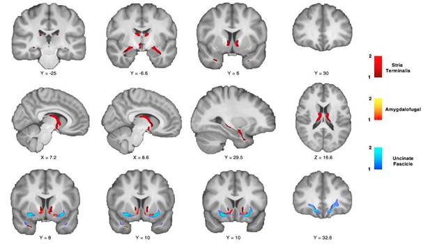 Dichotomous organization of amygdala/temporal-prefrontal bundles in ...