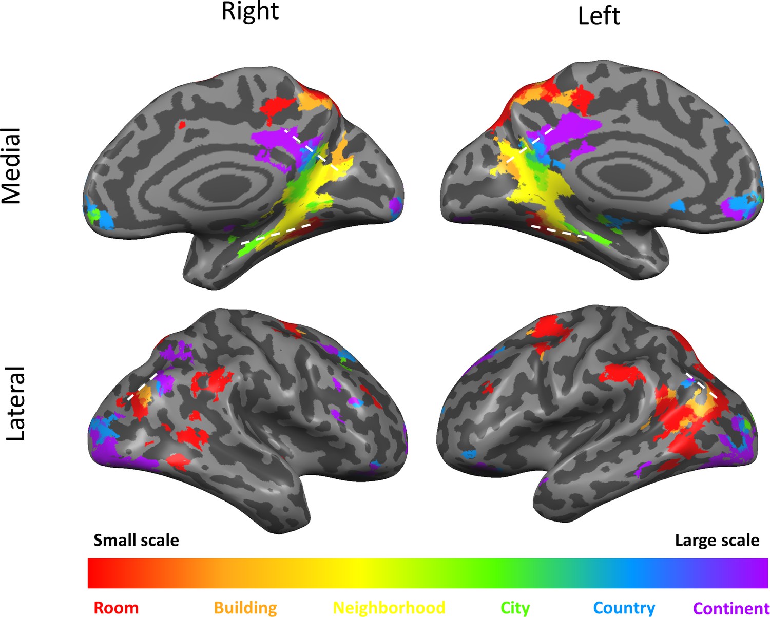 Processing of different spatial scales in the human brain