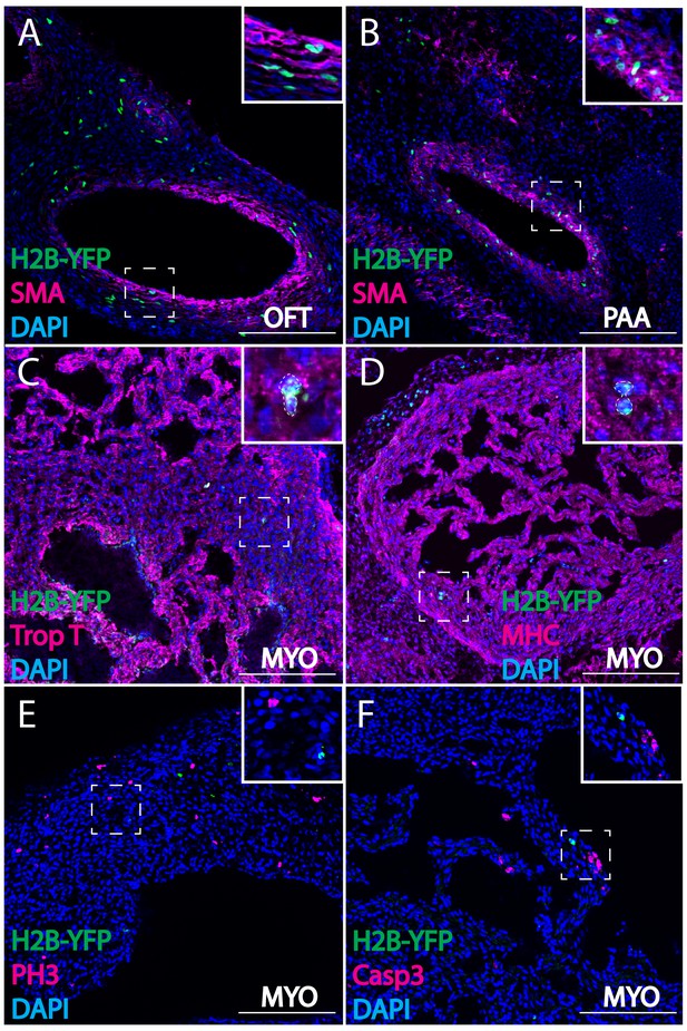 Cardiac Neural Crest Contributes To Cardiomyocytes In Amniotes And