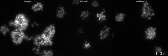 B cells extract antigens at Arp2/3-generated actin foci interspersed ...