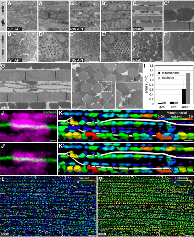 Figures and data in Matrix metalloproteinase 1 modulates invasive ...