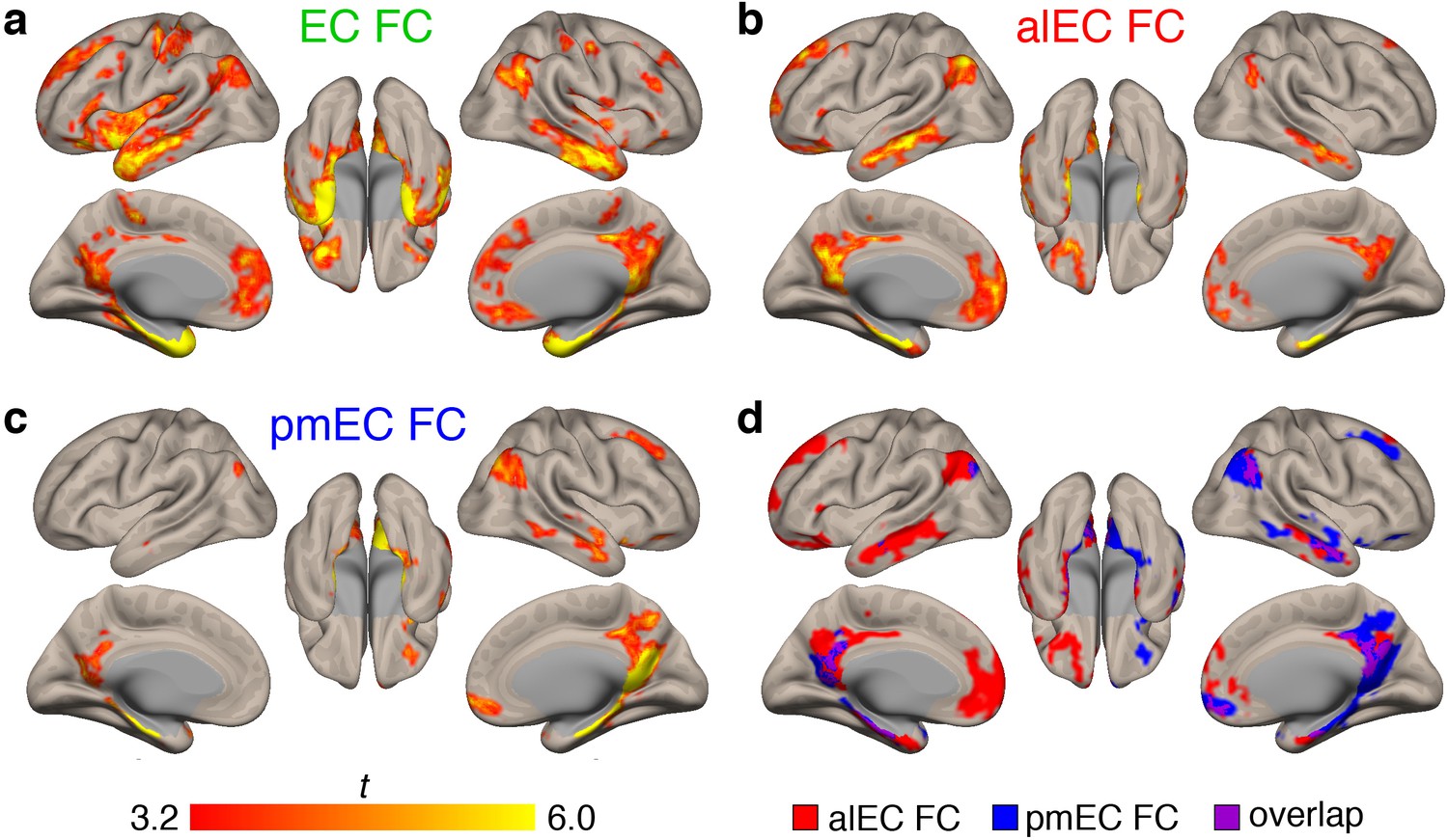 Figures and data in Cortical tau deposition follows patterns of ...