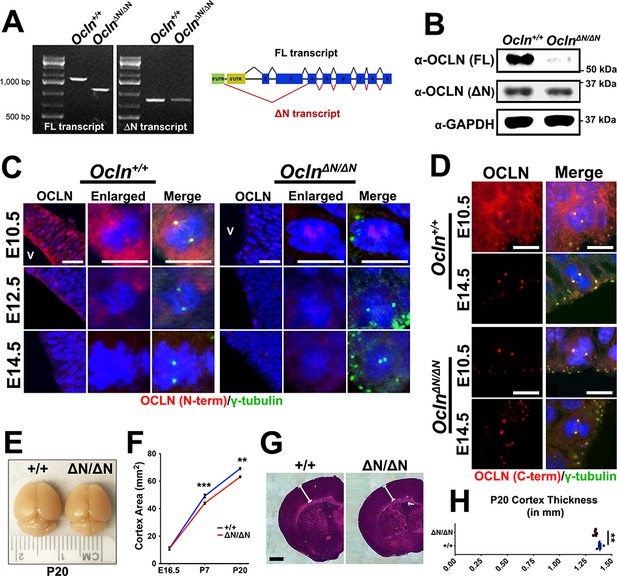 Figures And Data In Tight Junction Protein Occludin Regulates