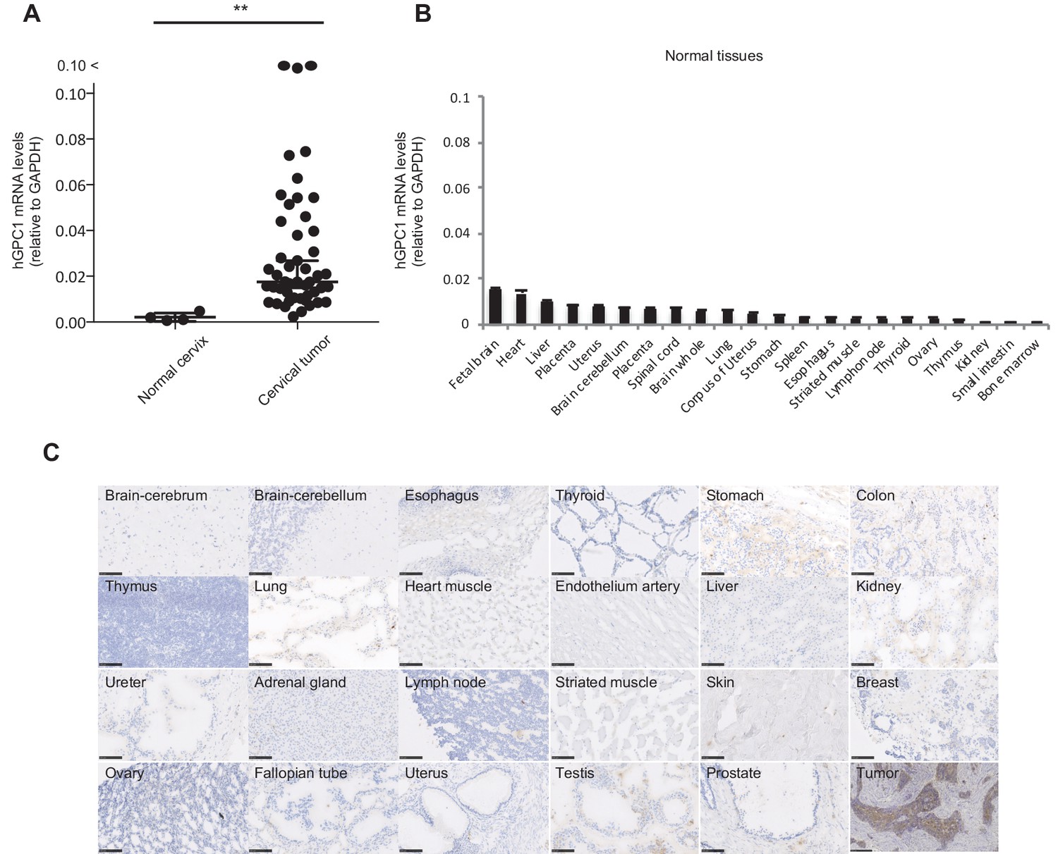 GPC1 specific CAR-T cells eradicate established solid tumor without adverse  effects and synergize with anti-PD-1 Ab | eLife