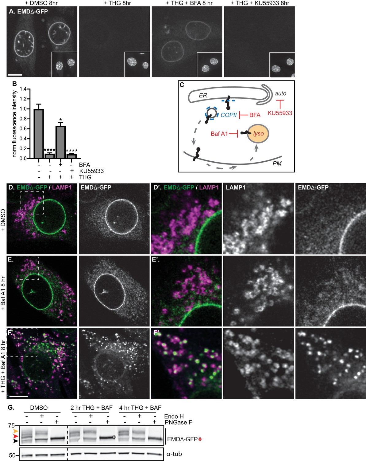 Selective clearance of the inner nuclear membrane protein emerin 