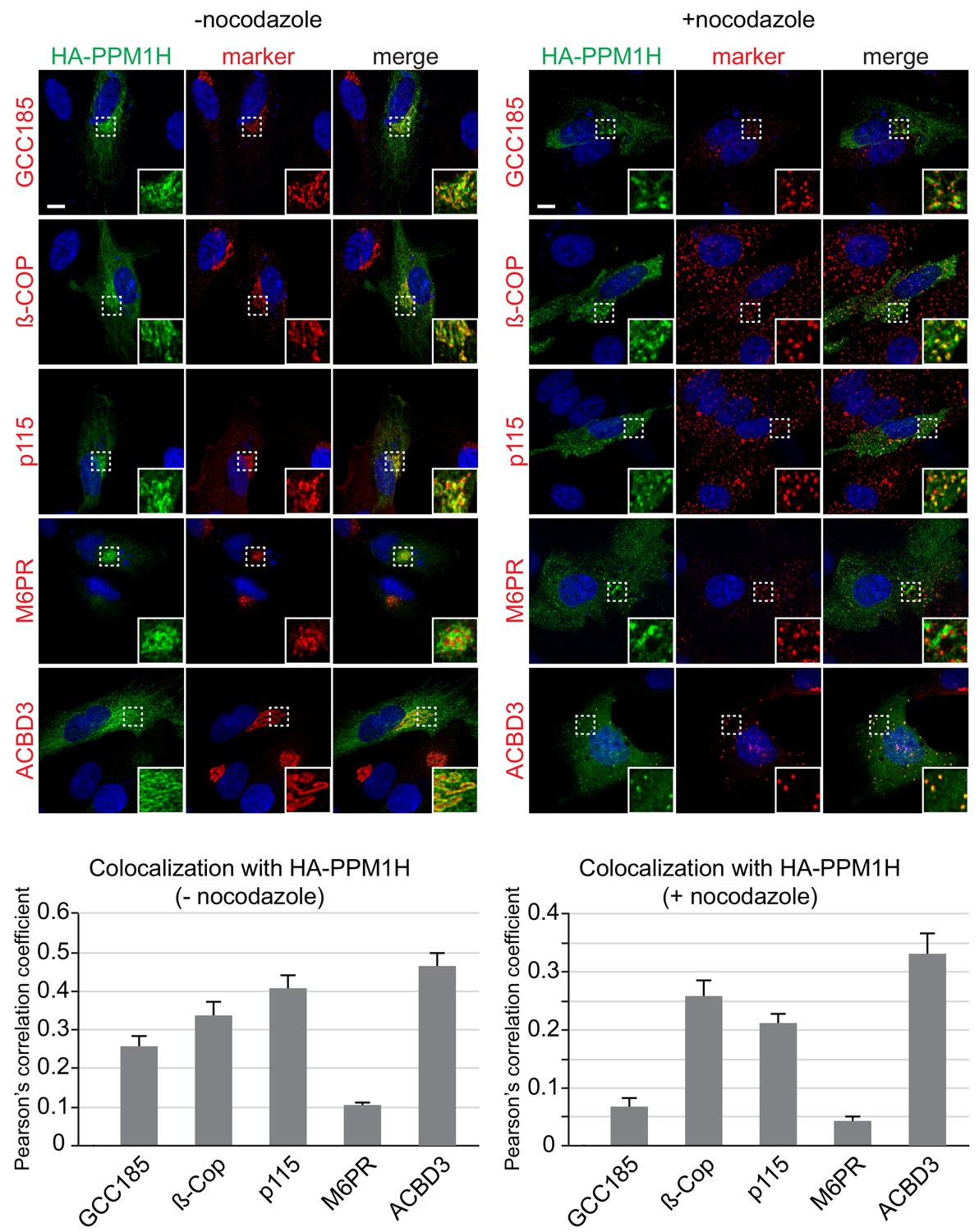 Figures And Data In Ppm H Phosphatase Counteracts Lrrk Signaling By