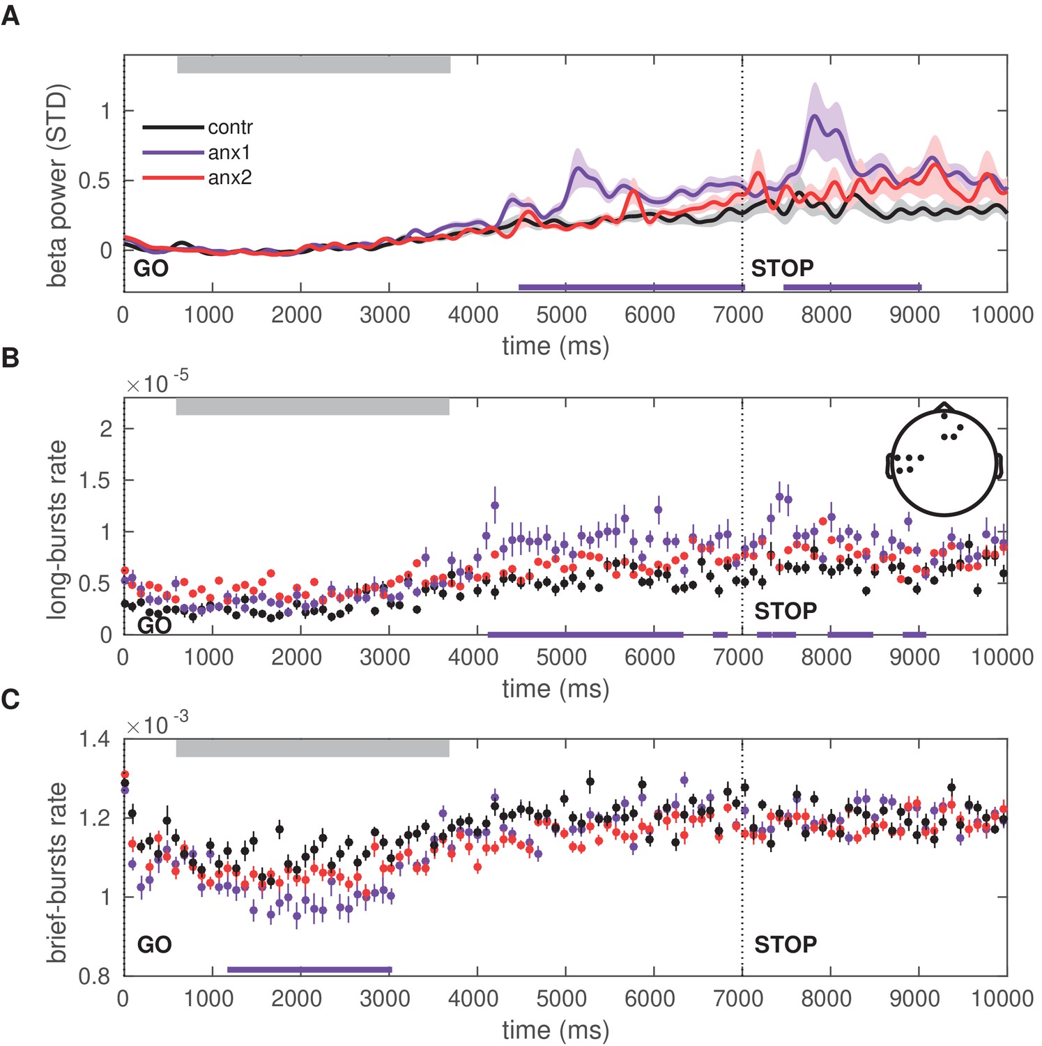 Alterations In The Amplitude And Burst Rate Of Beta Oscillations Impair Reward Dependent Motor Learning In Anxiety Elife