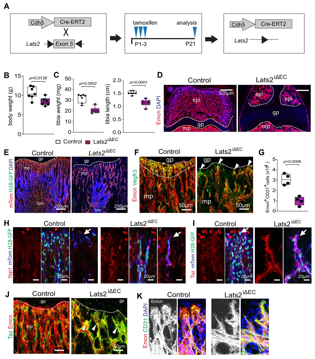 Figures and data in YAP1 and TAZ negatively control bone angiogenesis ...