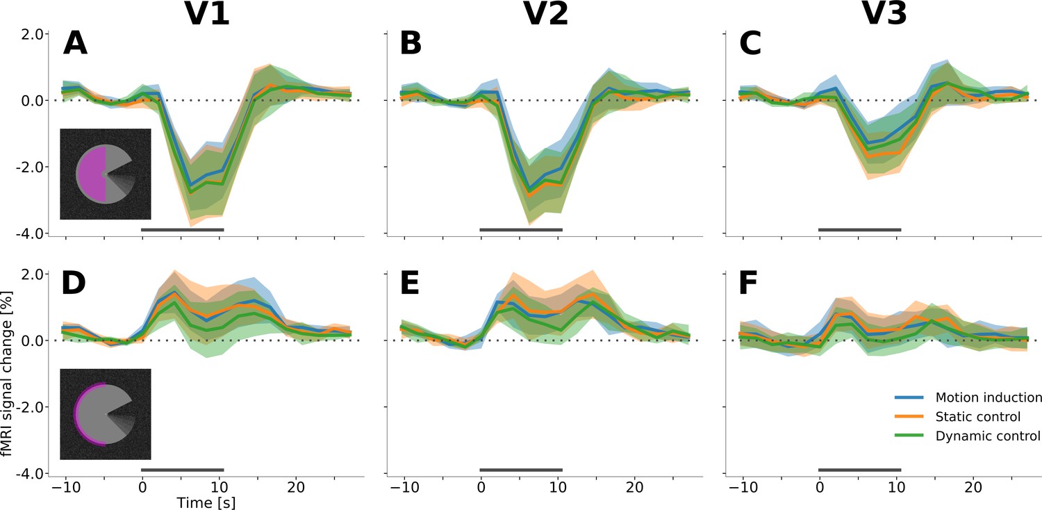 Figures And Data In Feedback Contribution To Surface Motion Perception In The Human Early Visual 1531