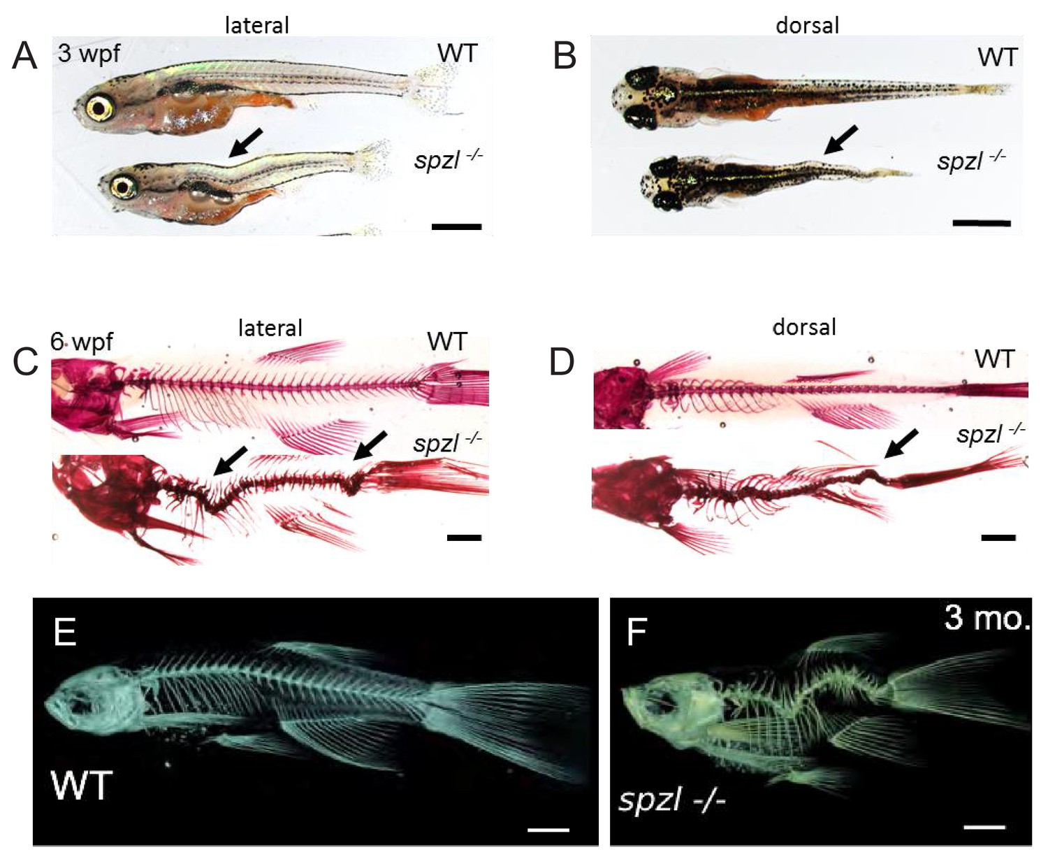 Notochord vacuoles absorb compressive bone growth during zebrafish ...