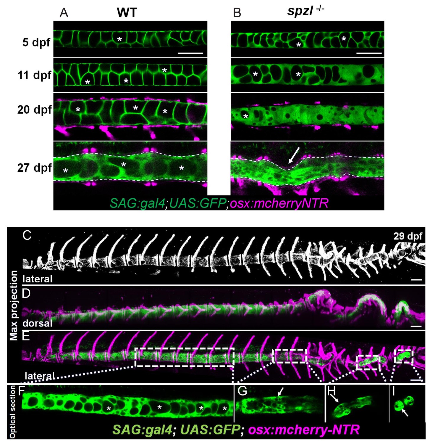 Notochord vacuoles absorb compressive bone growth during zebrafish ...