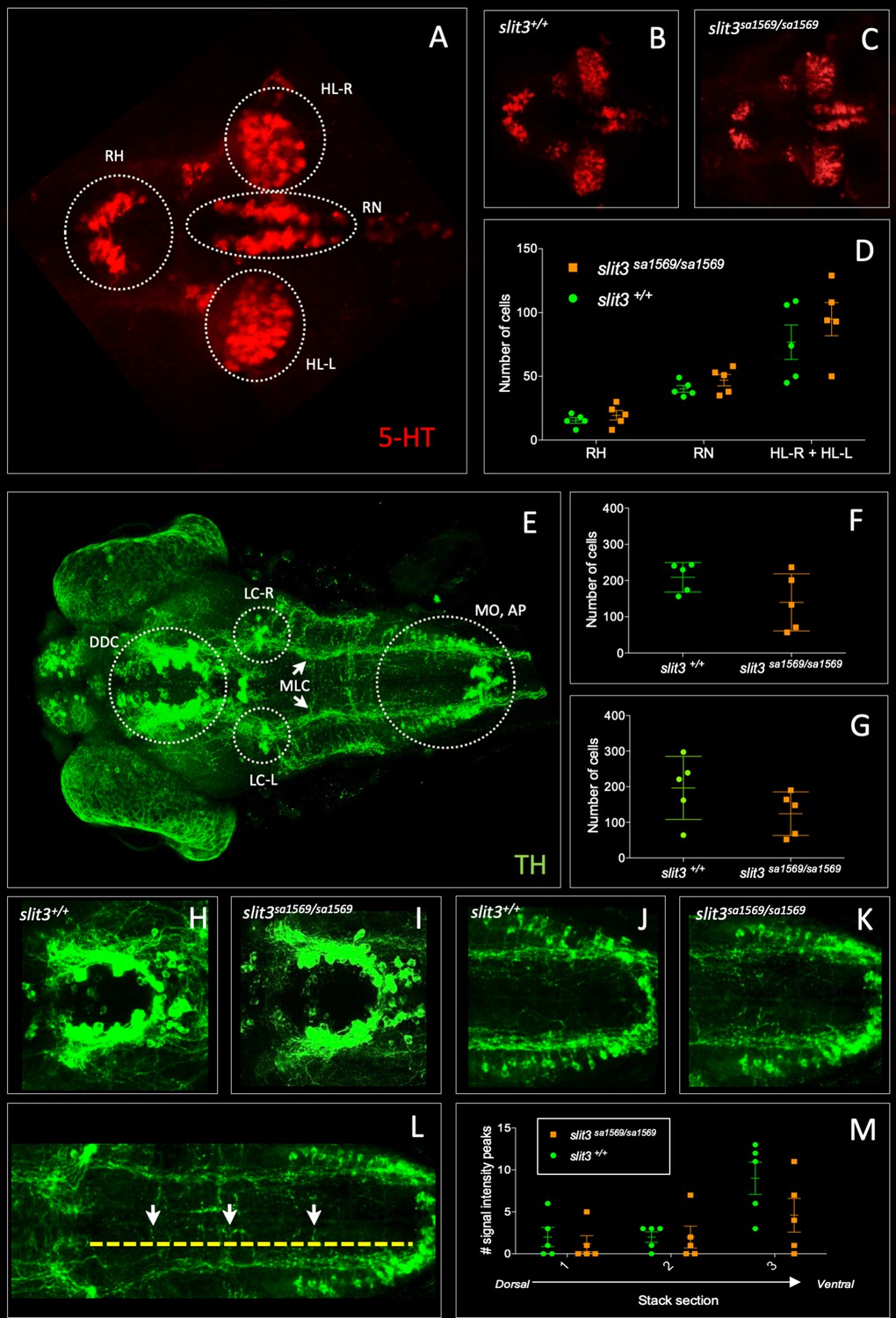 Identification of slit3 as a locus affecting nicotine preference