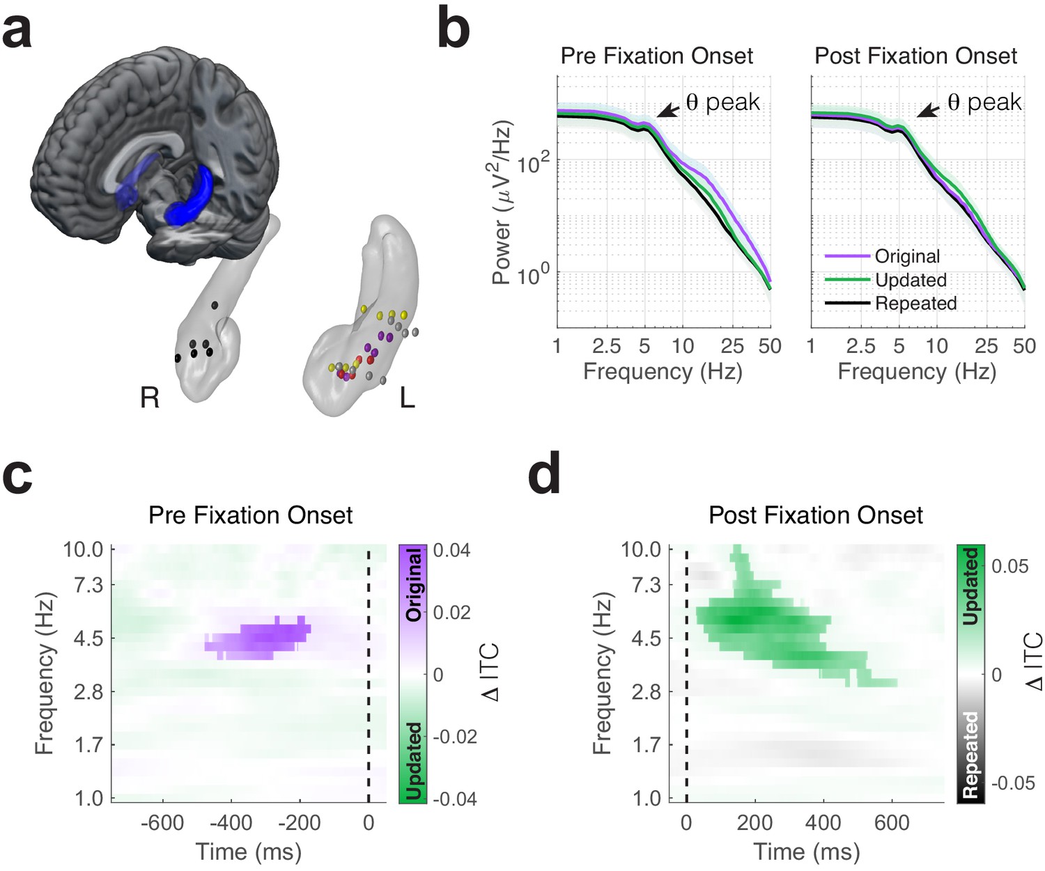 Aversive memory formation in humans involves an amygdala-hippocampus phase  code