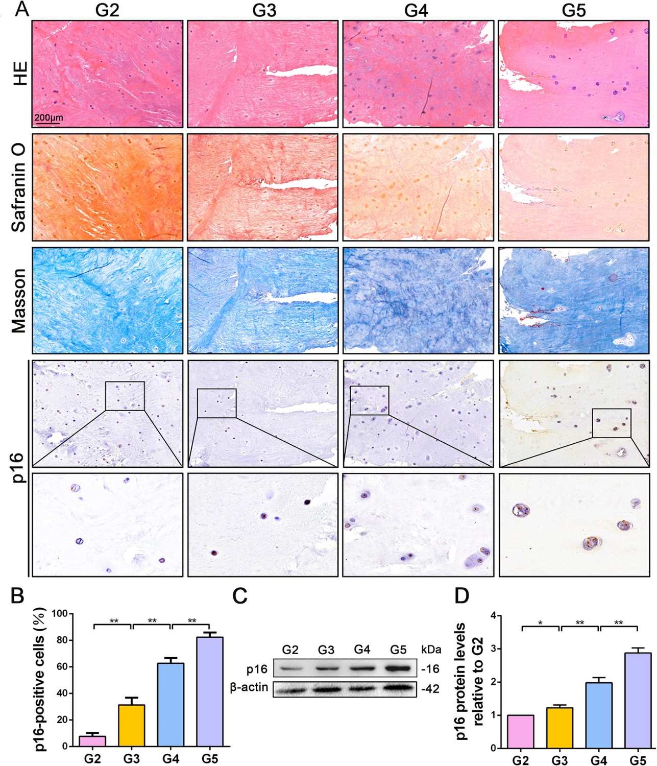 P16 Deficiency Attenuates Intervertebral Disc Degeneration By Adjusting ...