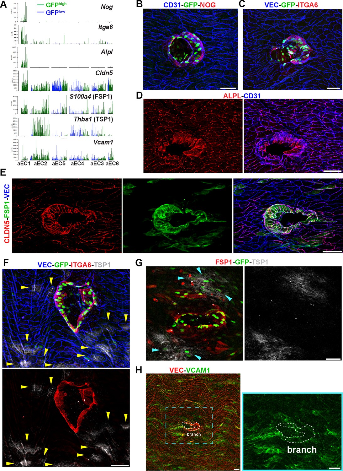 Sphingosine 1 Phosphate Regulated Transcriptomes In Heterogenous Arterial And Lymphatic Endothelium Of The Aorta Elife