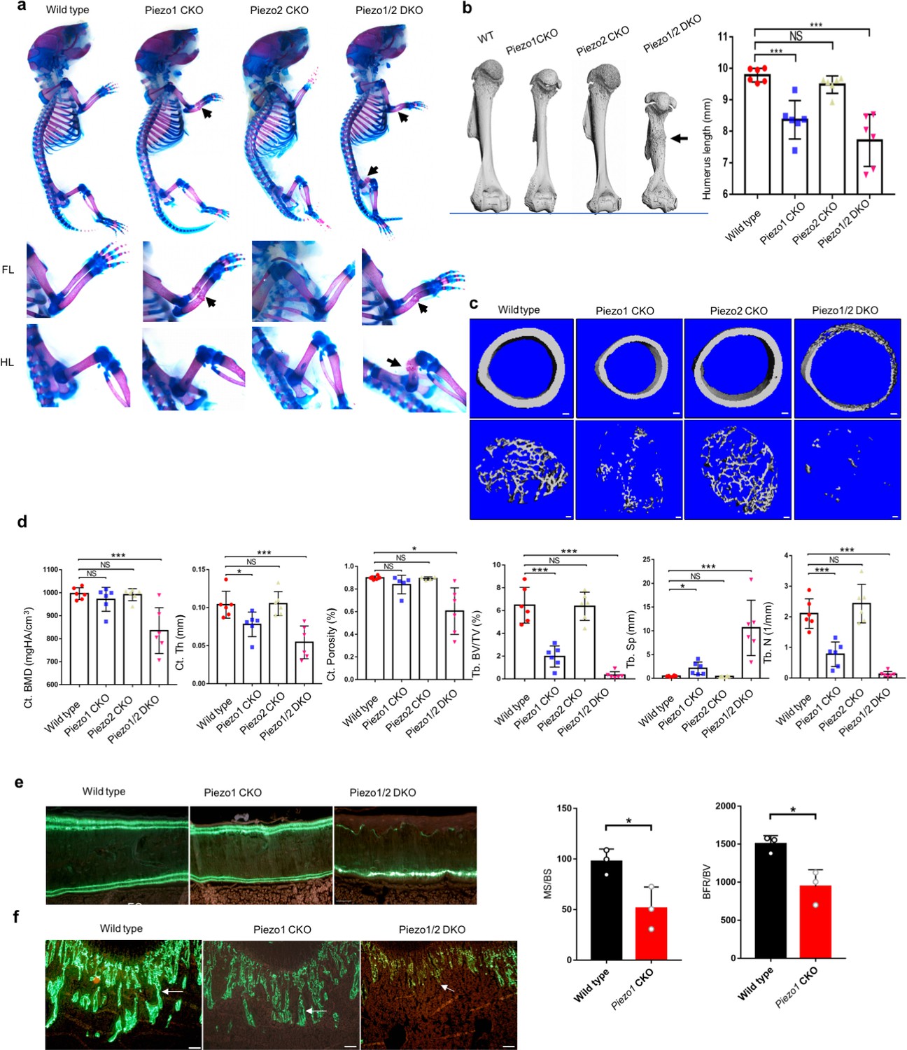 Piezo1 2 Mediate Mechanotransduction Essential For Bone Formation Through Concerted Activation Of Nfat Yap1 Ss Catenin Elife