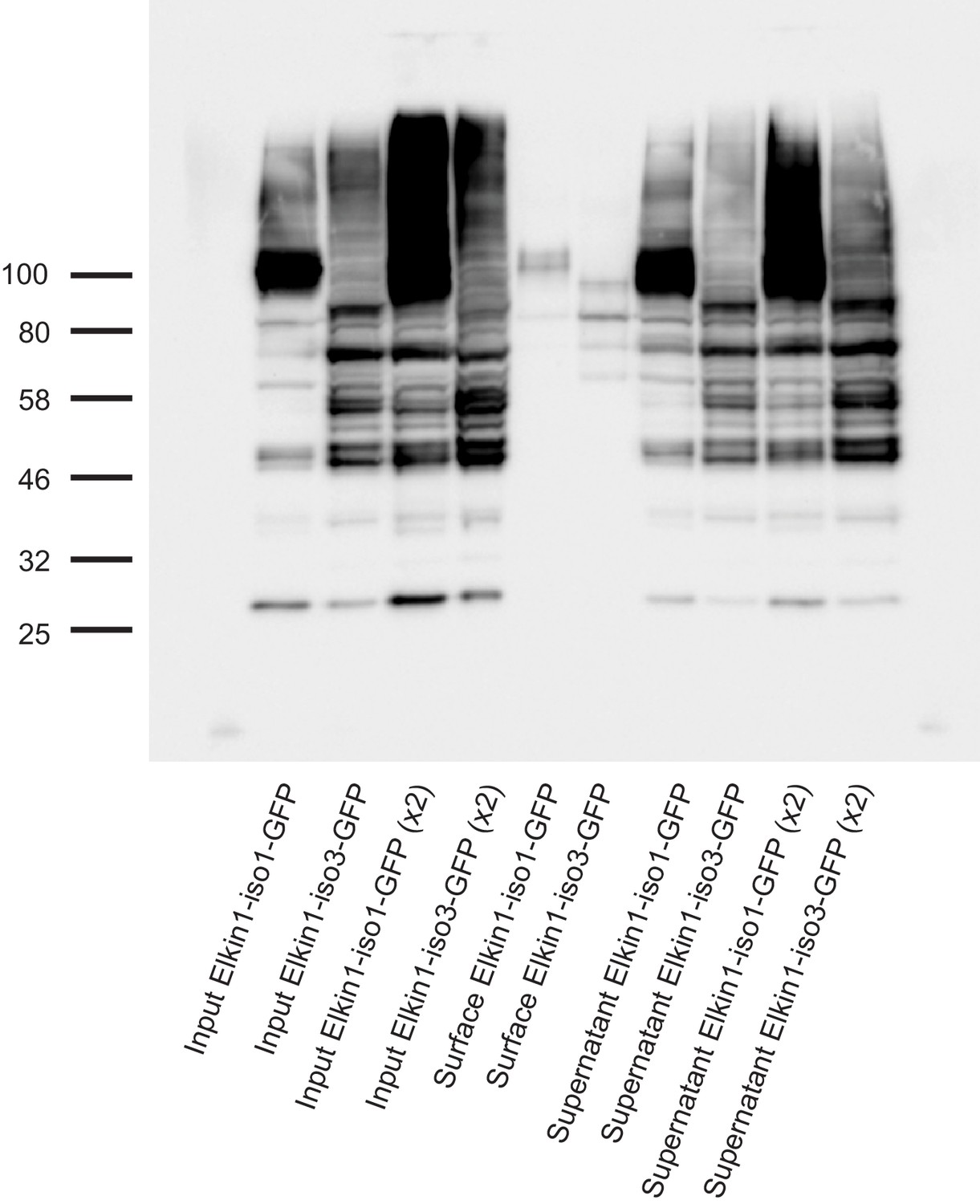 TMEM87a/Elkin1, a component of a novel mechanoelectrical