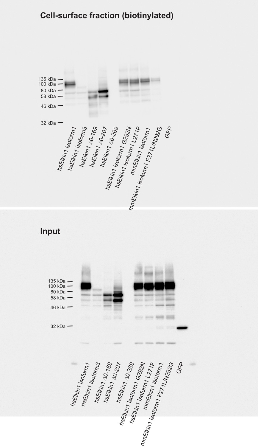 TMEM87a/Elkin1, a component of a novel mechanoelectrical