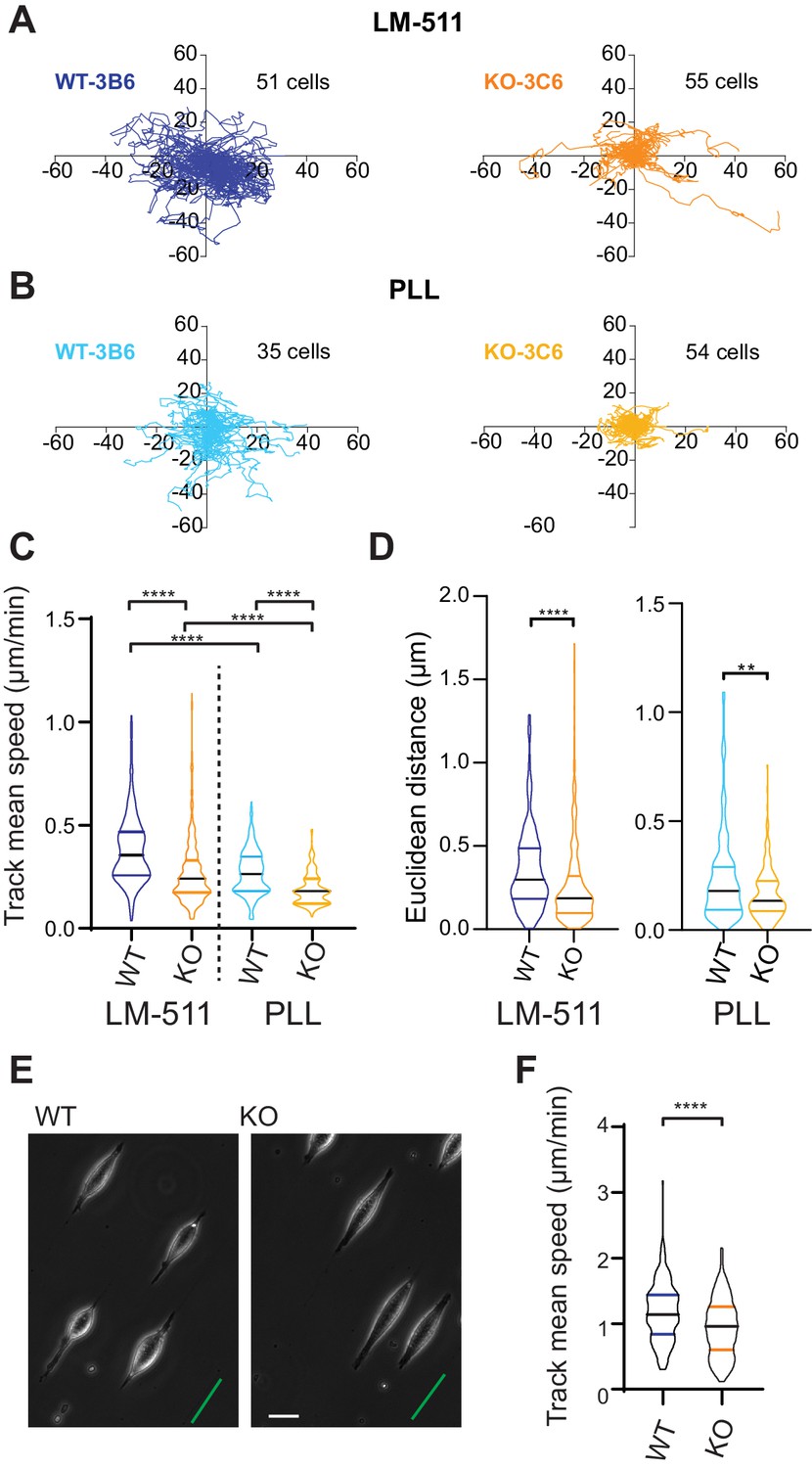 TMEM87a/Elkin1, a component of a novel mechanoelectrical