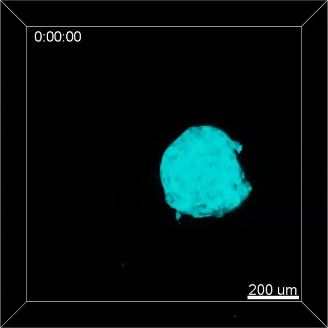 TMEM87a/Elkin1, a component of a novel mechanoelectrical