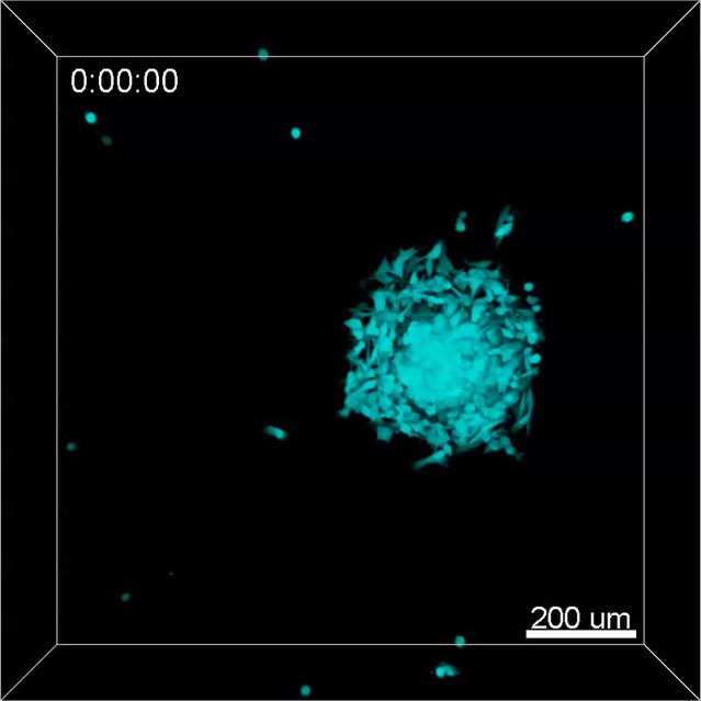 TMEM87a/Elkin1, a component of a novel mechanoelectrical