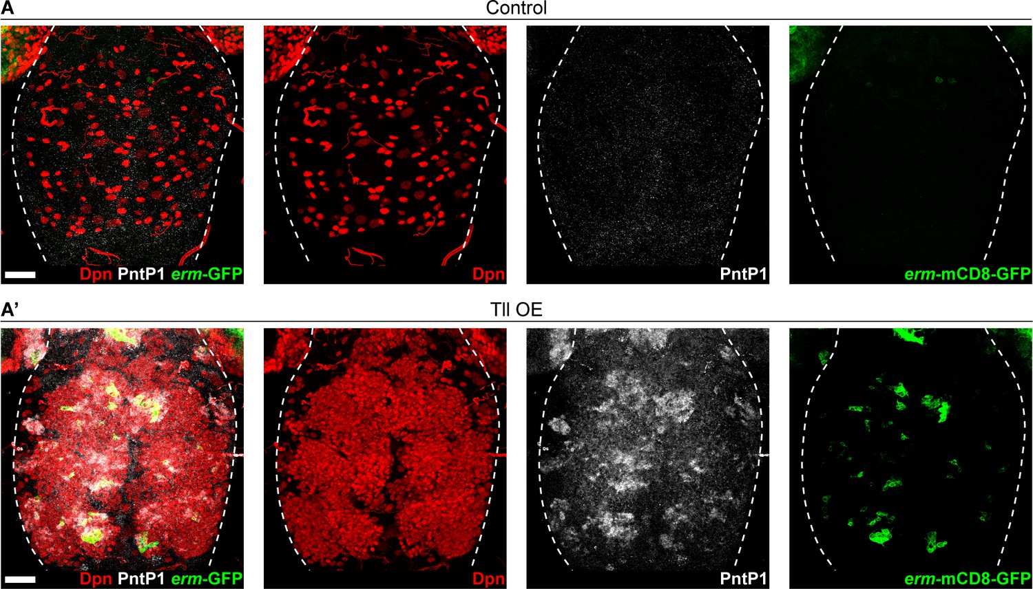 Figures and data in Tailless/TLX reverts intermediate neural ...