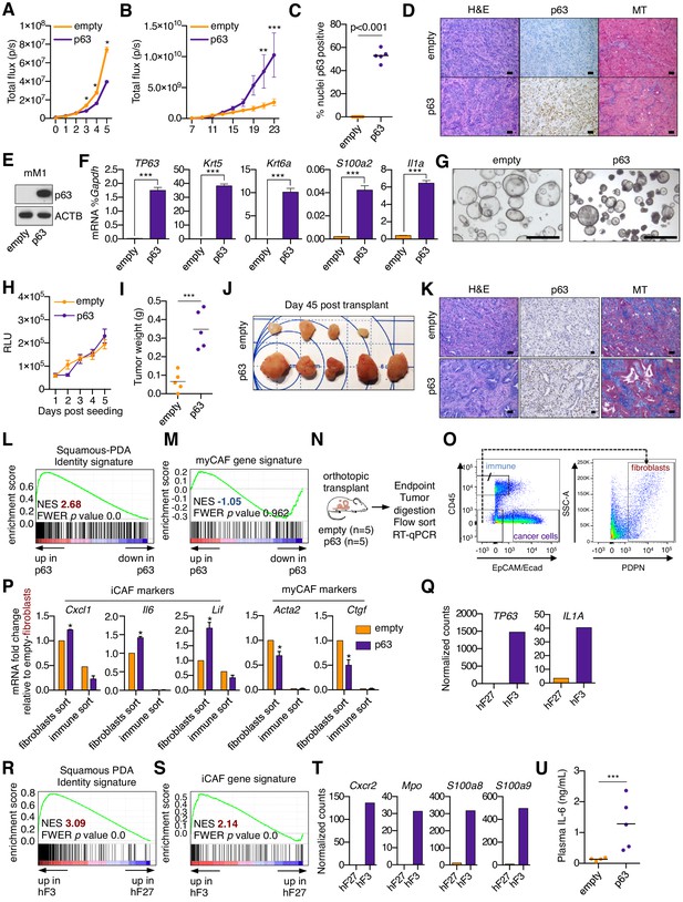 Figures and data in Squamous trans-differentiation of pancreatic cancer ...